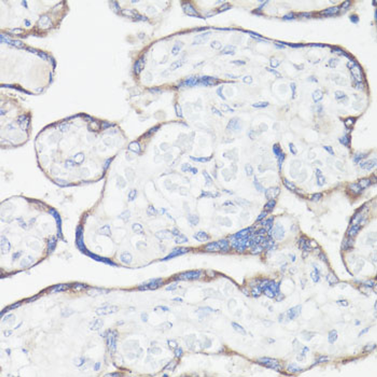 Immunohistochemistry of paraffin-embedded Human placenta using CLUH Polyclonal Antibody at dilution of  1:100 (40x lens).