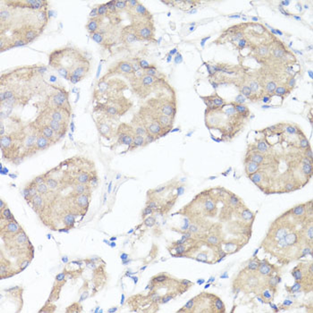 Immunohistochemistry of paraffin-embedded Human stomach using CLUH Polyclonal Antibody at dilution of  1:100 (40x lens).