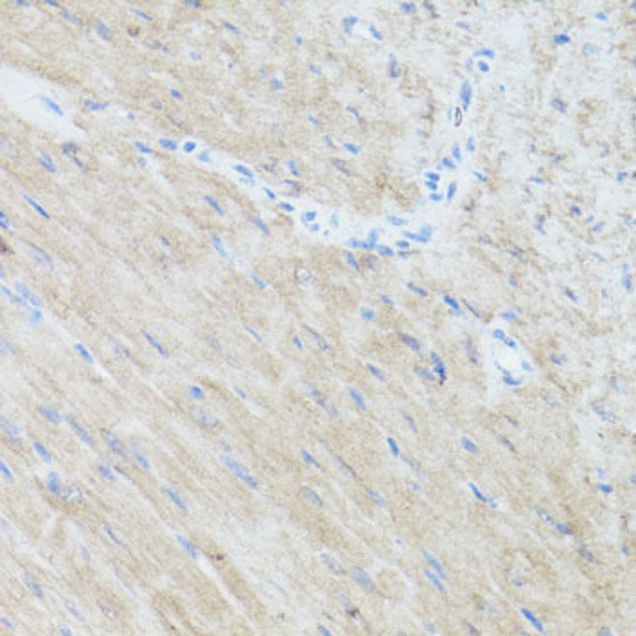 Immunohistochemistry of paraffin-embedded Mouse heart using CLUH Polyclonal Antibody at dilution of  1:100 (40x lens).