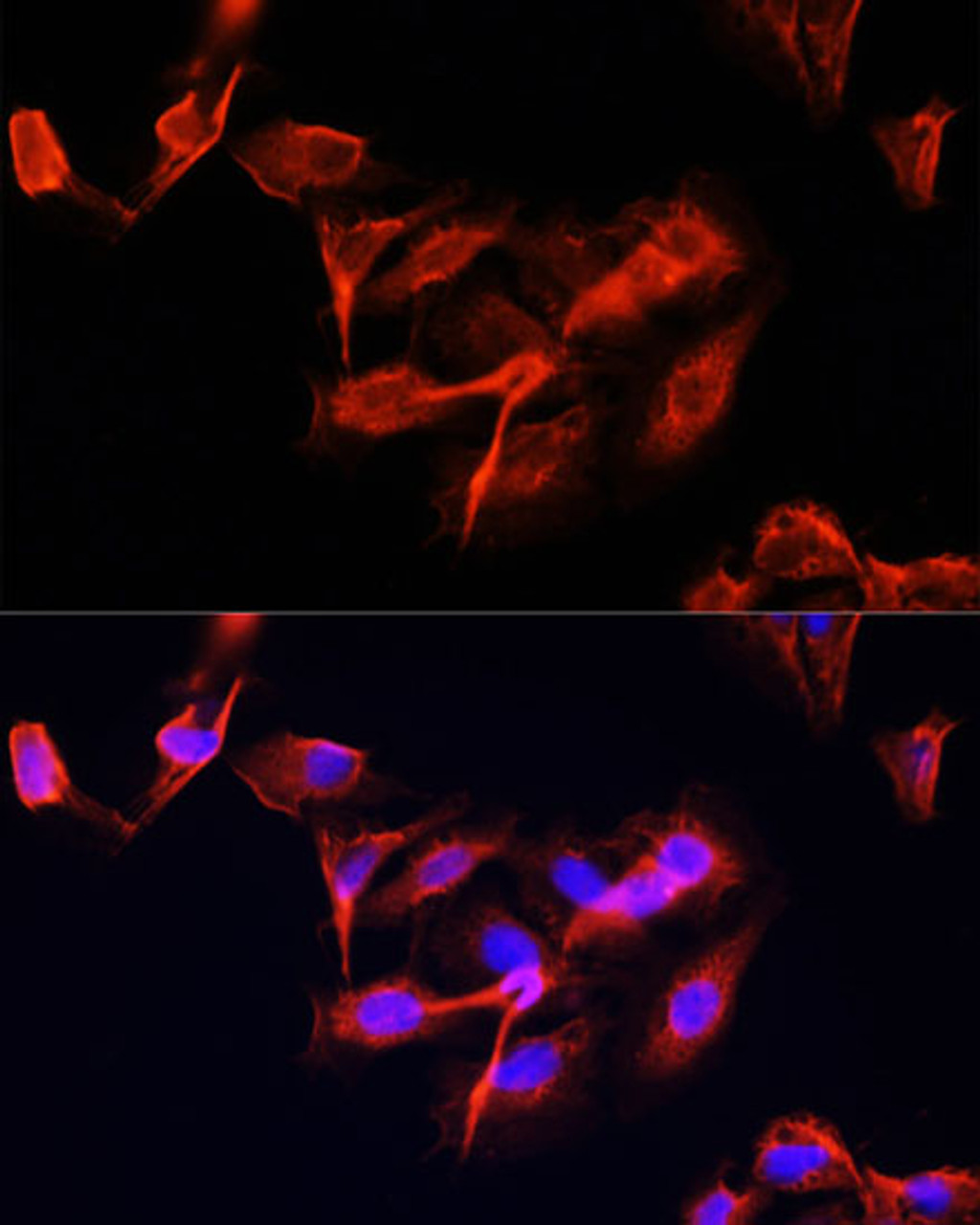 Immunofluorescence analysis of U-2 OS cells using CLUH Polyclonal Antibody at dilution of  1:100 (40x lens). Blue: DAPI for nuclear staining.