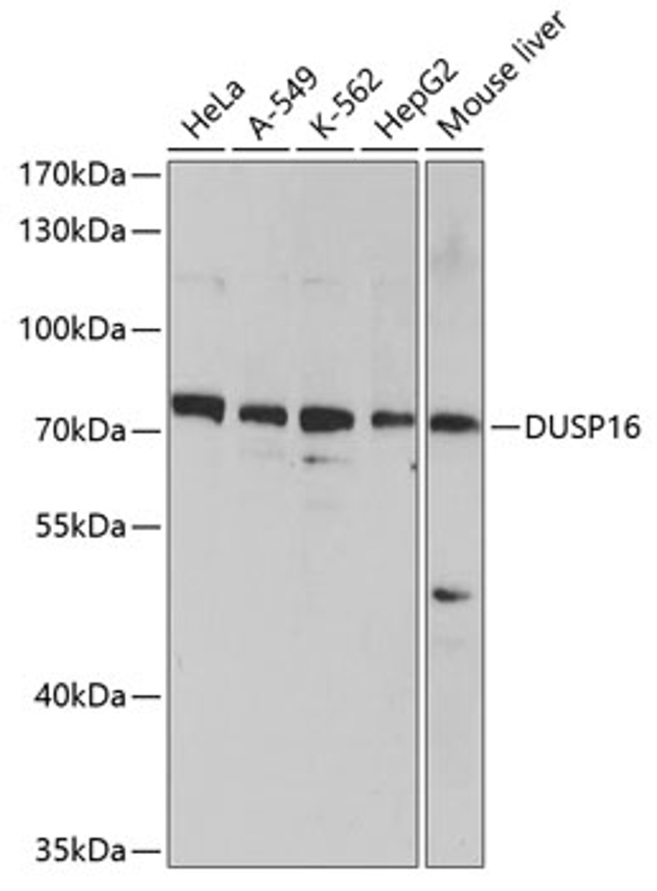 Western blot analysis of extracts of various cell lines using DUSP16 Polyclonal Antibody at dilution of 1:1000.