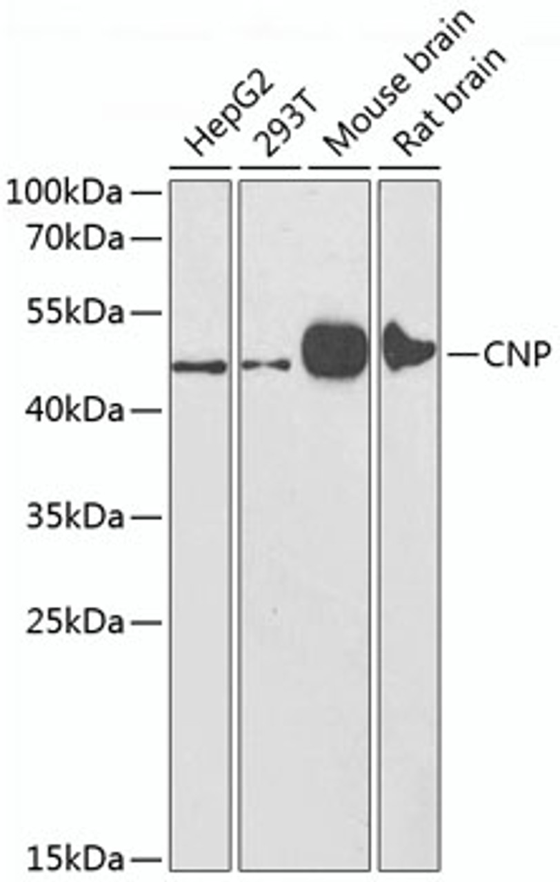 Western blot analysis of extracts of various cell lines using CNP Polyclonal Antibody at dilution of 1:1000.