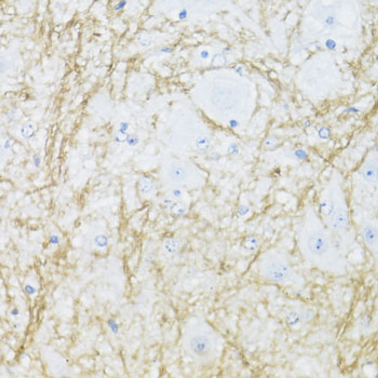 Immunohistochemistry of paraffin-embedded Mouse spinal cord using CNP Polyclonal Antibody at dilution of  1:100 (40x lens).