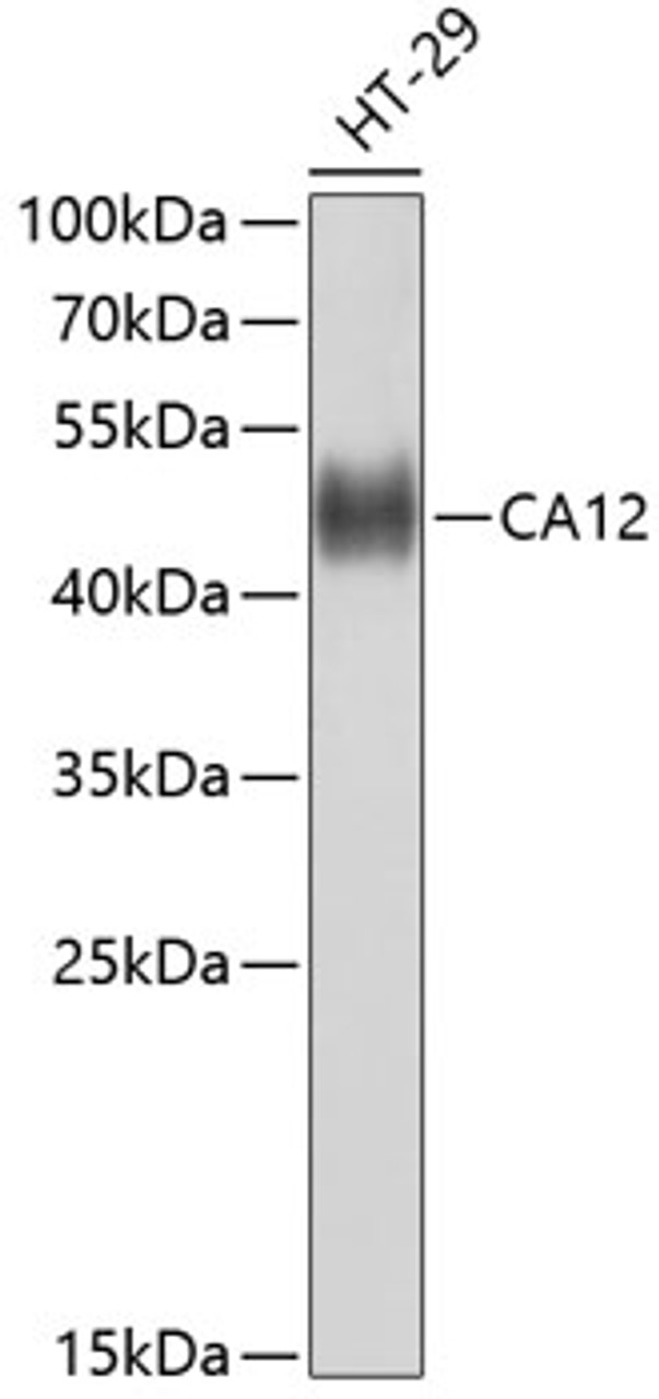 Western blot analysis of extracts of HT-29 cells using CA12 Polyclonal Antibody at dilution of 1:1000.