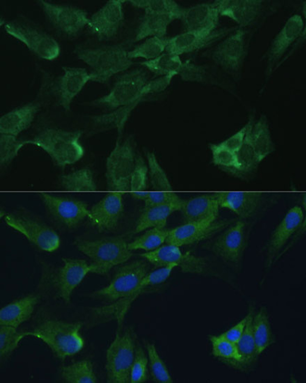 Immunofluorescence analysis of C6 cells using ADA Polyclonal Antibody at dilution of  1:100. Blue: DAPI for nuclear staining.