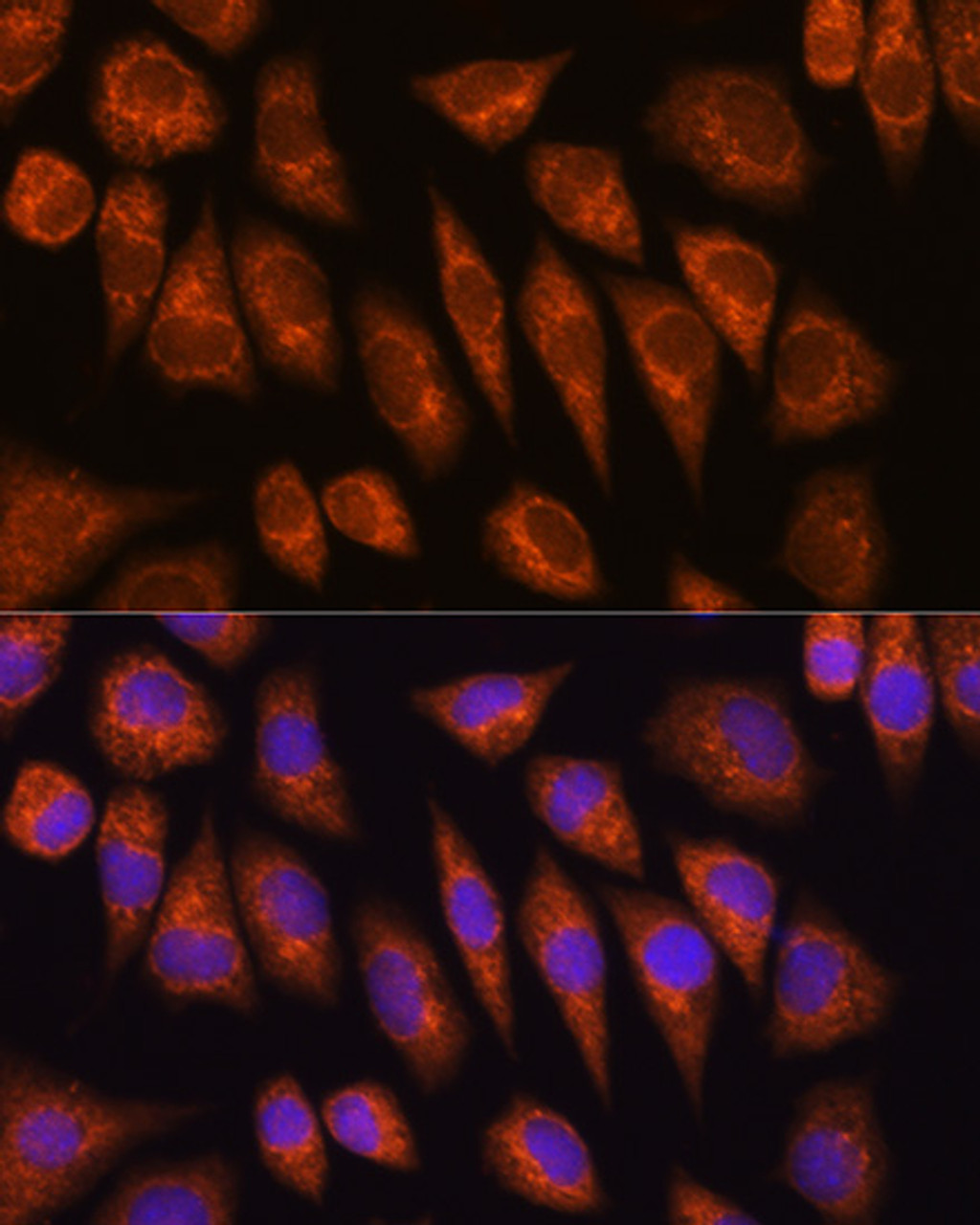 Immunofluorescence analysis of L929 cells using GOLGA4 Polyclonal Antibody at dilution of  1:100 (40x lens). Blue: DAPI for nuclear staining.