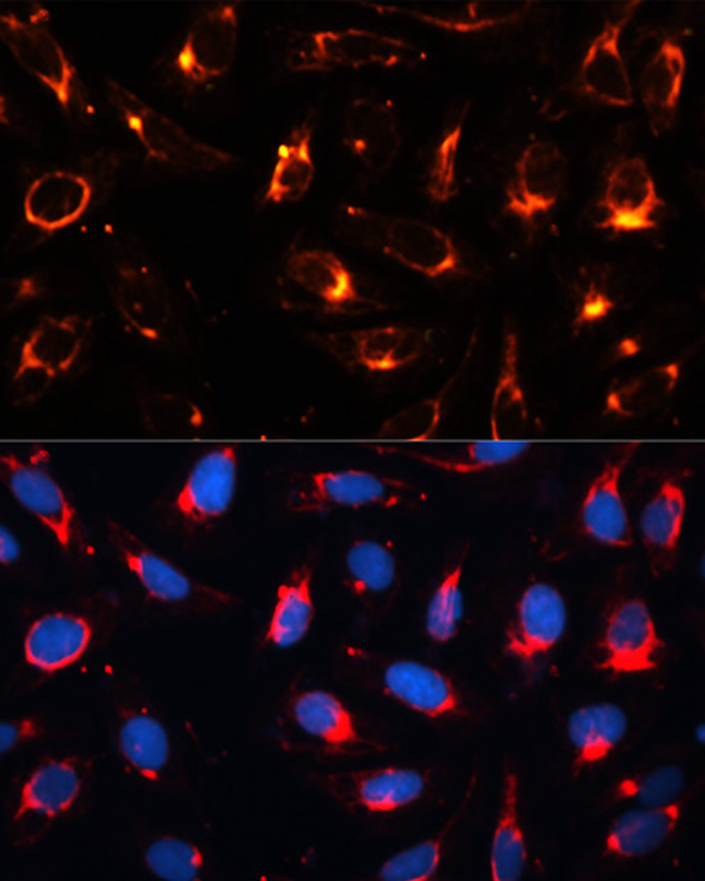 Immunofluorescence analysis of U2OS cells using CytokeRatin-18 Polyclonal Antibody at dilution of  1:100. Blue: DAPI for nuclear staining.