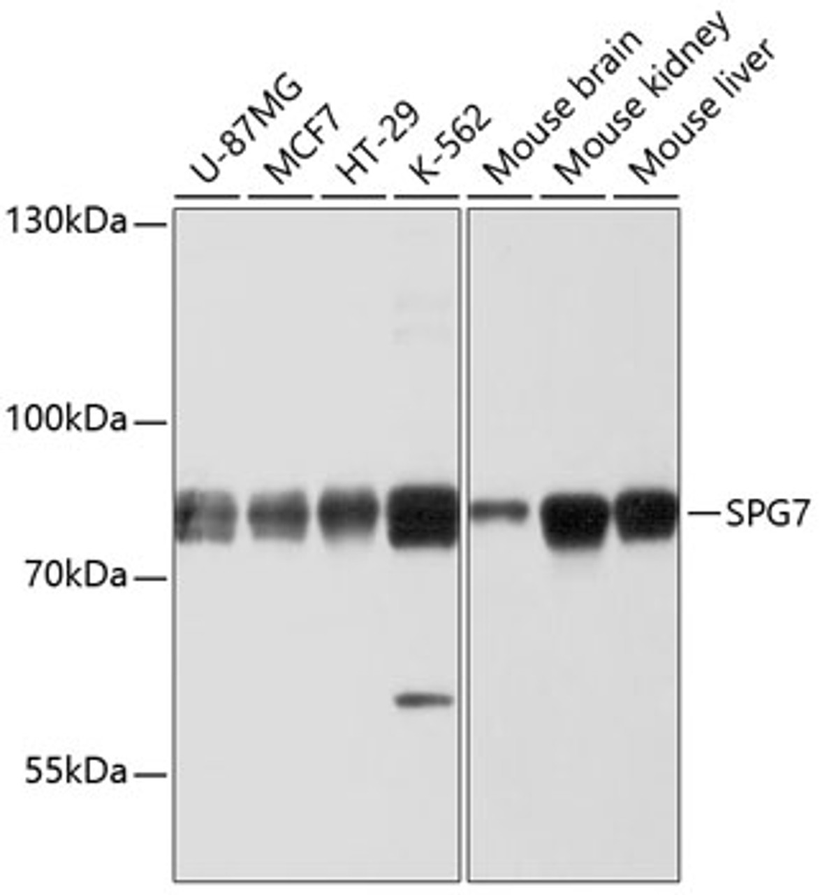 Western blot analysis of extracts of various cell lines using SPG7 Polyclonal Antibody at dilution of 1:1000.