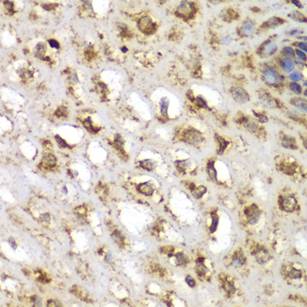 Immunohistochemistry of paraffin-embedded Human esophagus using SGK1 Polyclonal Antibody at dilution of  1:100 (40x lens).
