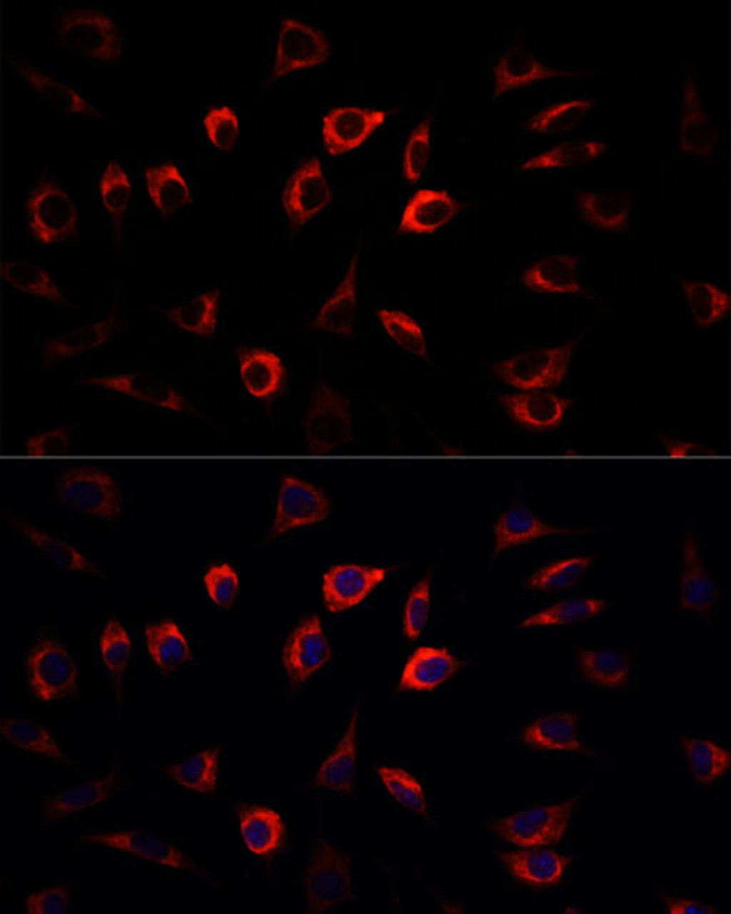 Immunofluorescence analysis of L929 cells using SGK1 Polyclonal Antibody at dilution of  1:100. Blue: DAPI for nuclear staining.