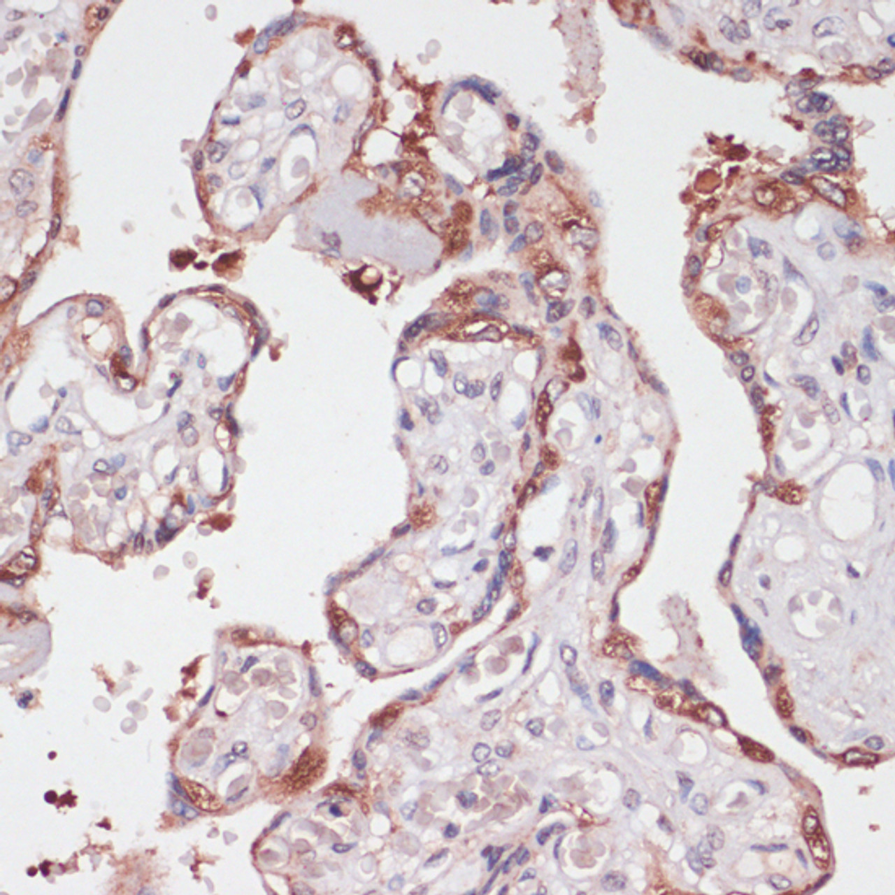 Immunohistochemistry of paraffin-embedded Human placenta using TPD52 Polyclonal Antibody at dilution of  1:100 (40x lens).
