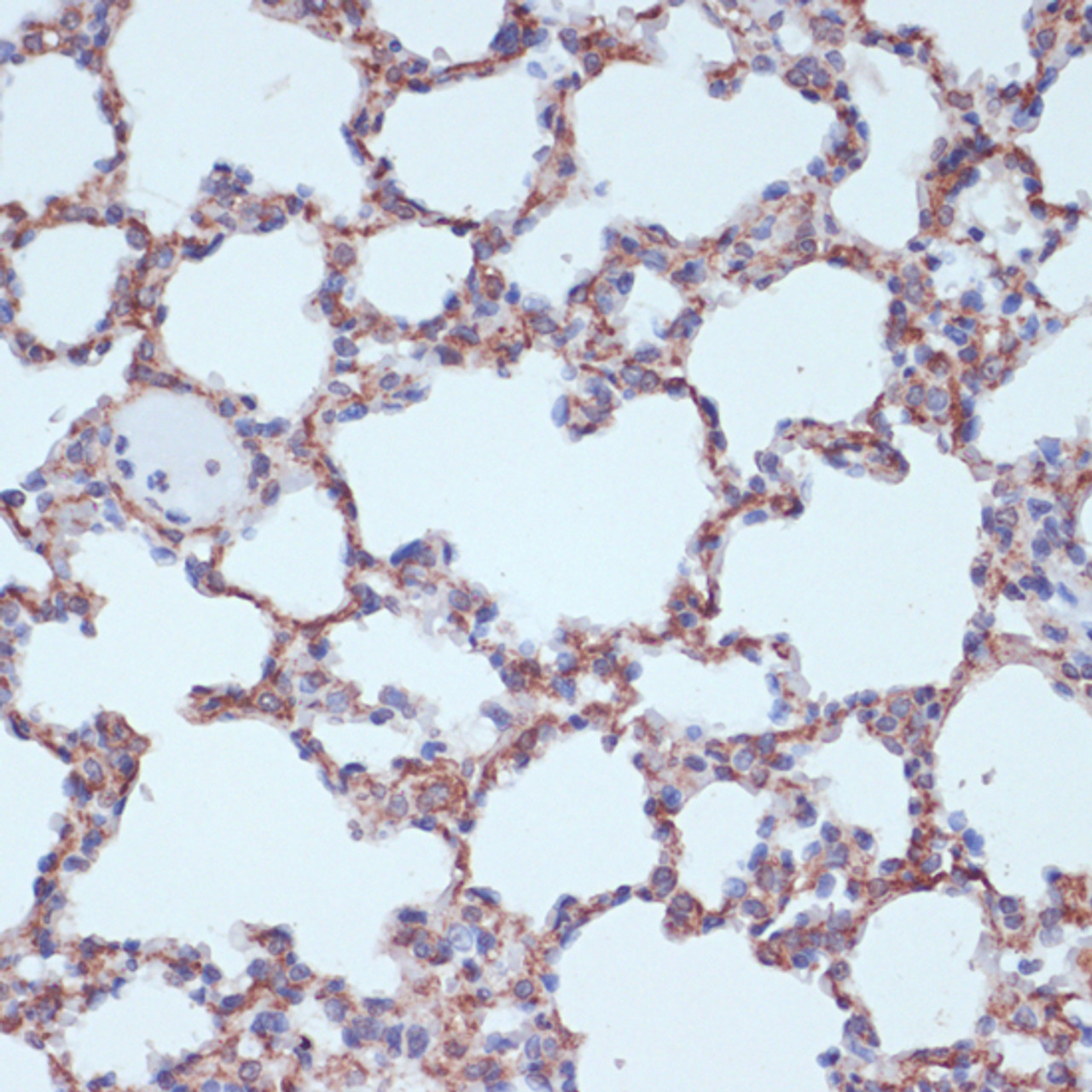 Immunohistochemistry of paraffin-embedded Rat lung using TPD52 Polyclonal Antibody at dilution of  1:100 (40x lens).