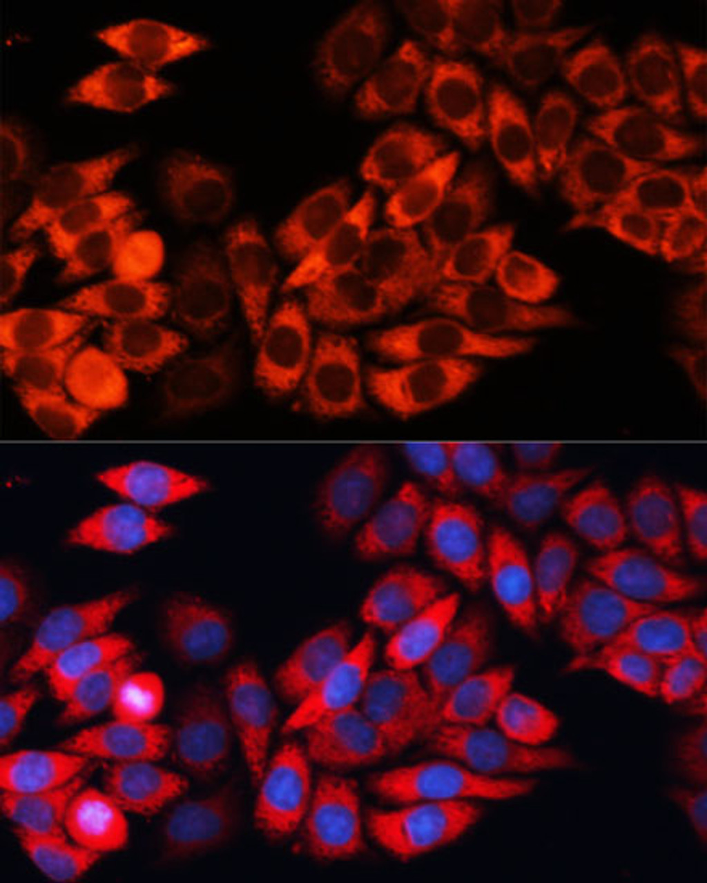 Immunofluorescence analysis of HeLa cells using EIF3B Polyclonal Antibody at dilution of  1:100 (40x lens). Blue: DAPI for nuclear staining.