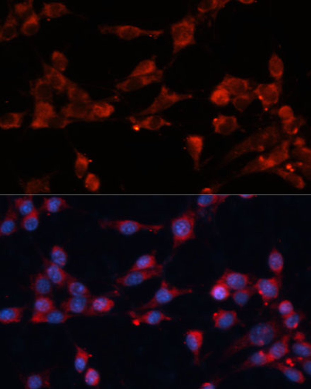 Immunofluorescence analysis of NIH-3T3 cells using EIF3B Polyclonal Antibody at dilution of  1:100 (40x lens). Blue: DAPI for nuclear staining.