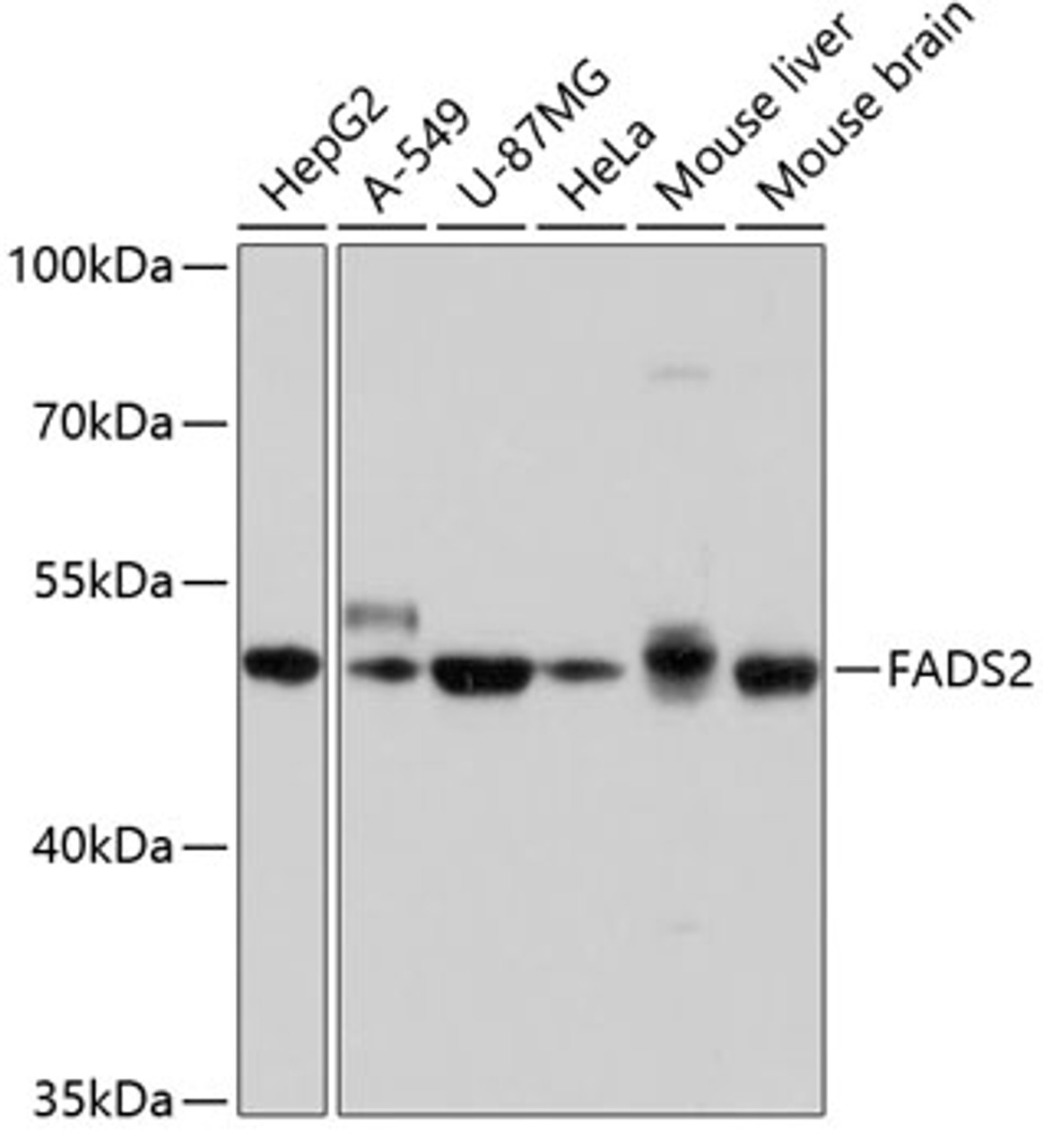 Western blot analysis of extracts of various cell lines using FADS2 Polyclonal Antibody at dilution of 1:1000.