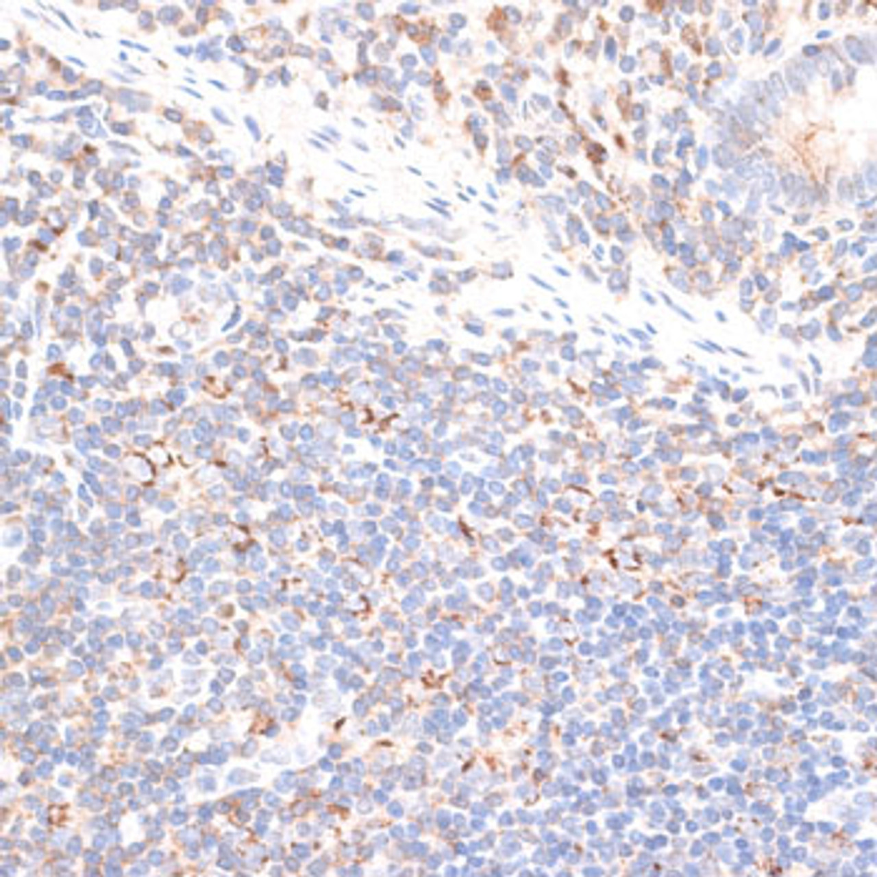 Immunohistochemistry of paraffin-embedded Human appendix using KIF14 Polyclonal Antibody at dilution of  1:100 (40x lens).