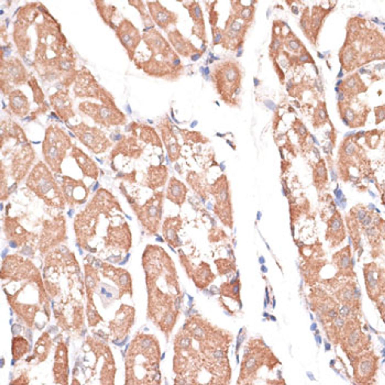 Immunohistochemistry of paraffin-embedded Human stomach using KIF14 Polyclonal Antibody at dilution of  1:100 (40x lens).