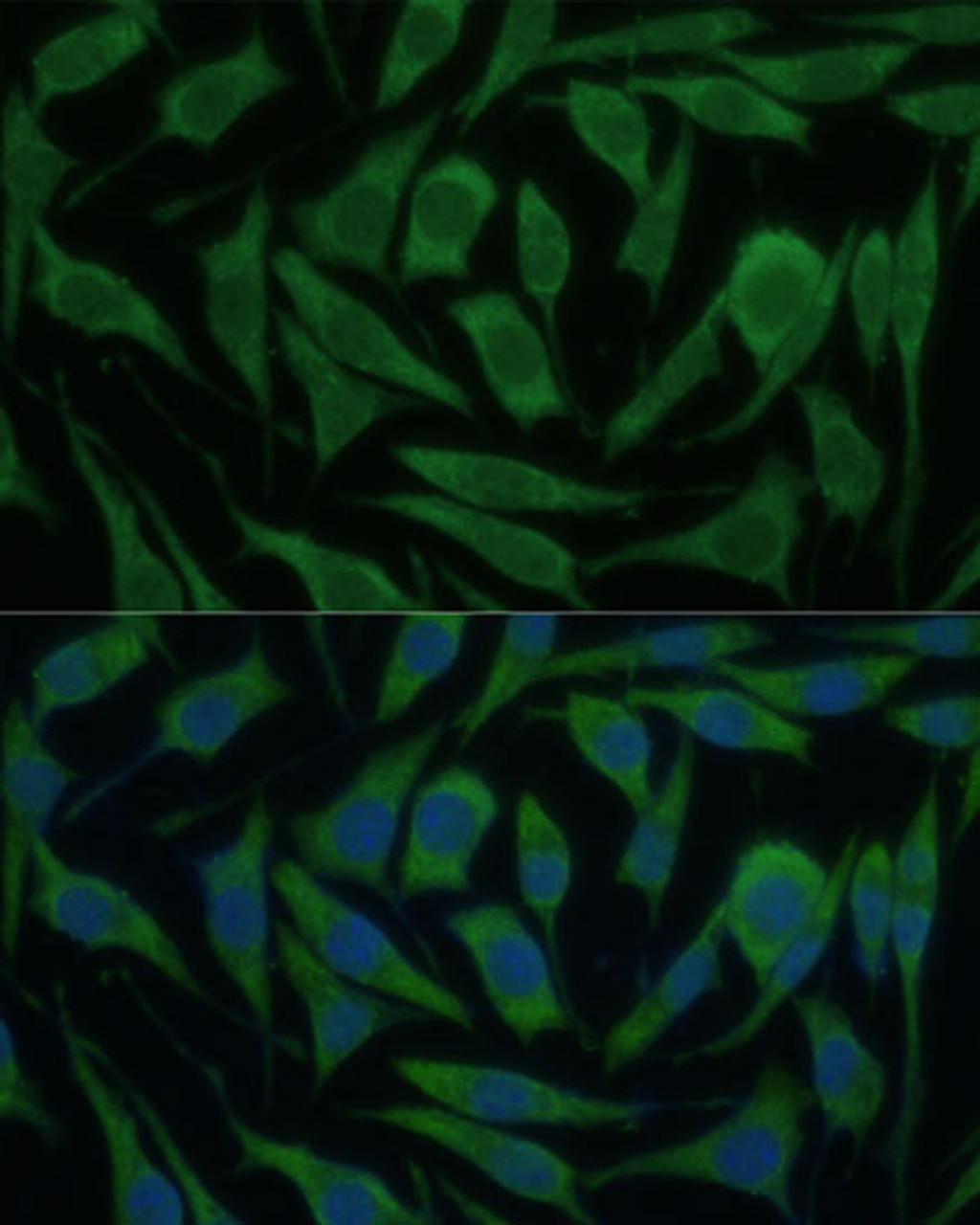 Immunofluorescence analysis of L929 cells using KIF14 Polyclonal Antibody at dilution of  1:100 (40x lens). Blue: DAPI for nuclear staining.