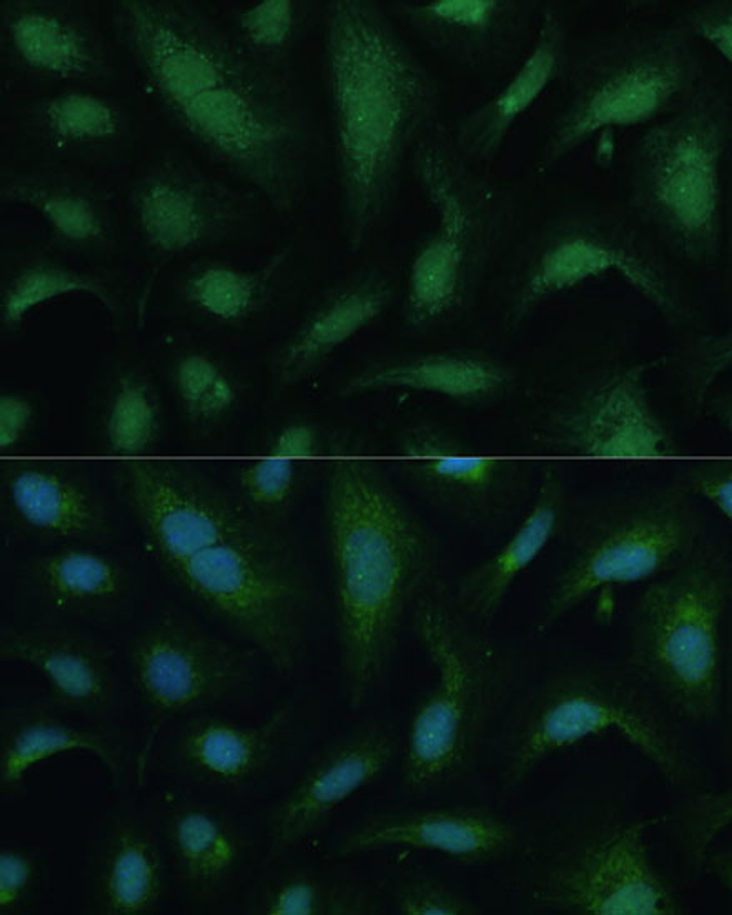 Immunofluorescence analysis of U-2 OS cells using KIF14 Polyclonal Antibody at dilution of  1:100 (40x lens). Blue: DAPI for nuclear staining.