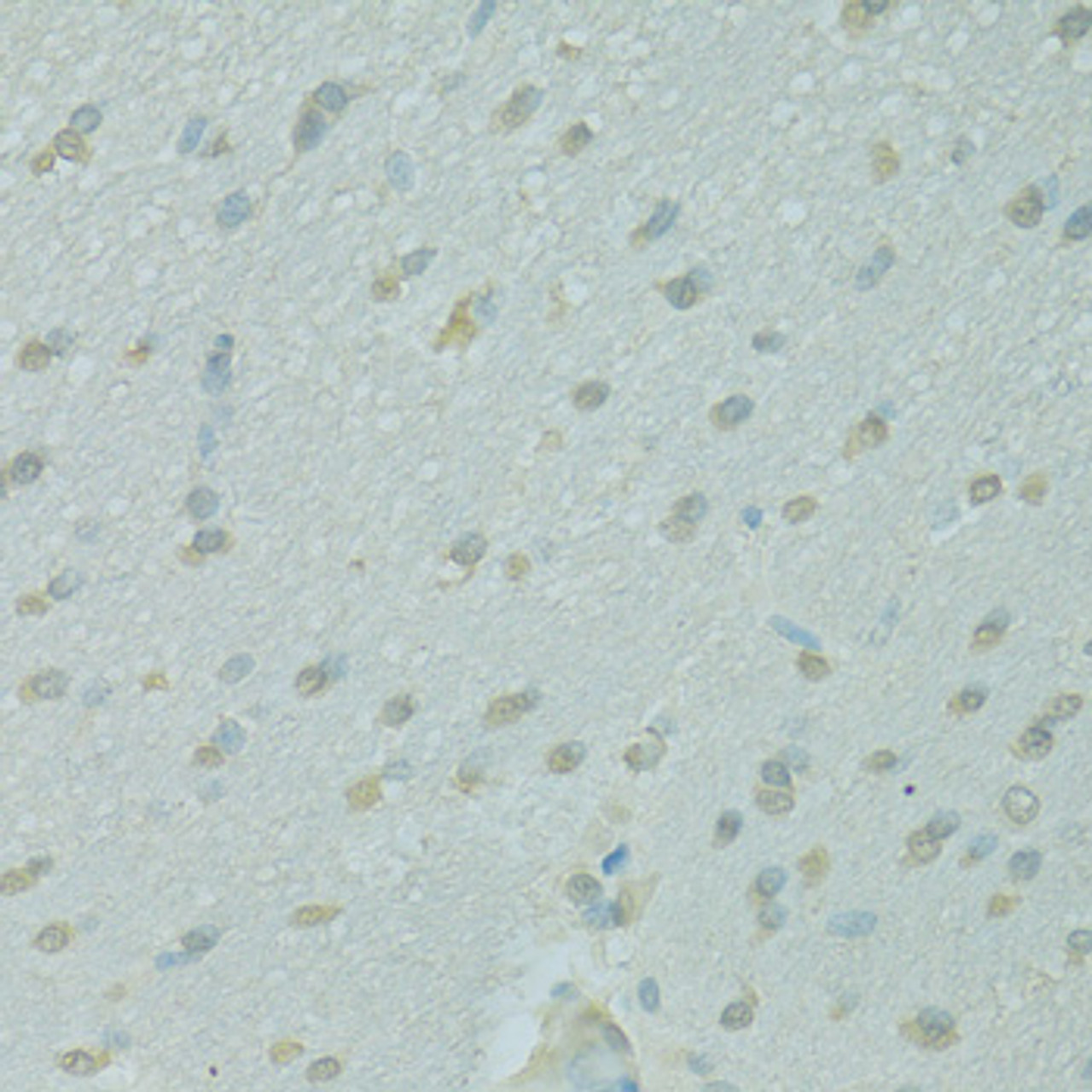 Immunohistochemistry of paraffin-embedded Rat brain using NCOA2 Polyclonal Antibody at dilution of  1:100 (40x lens).