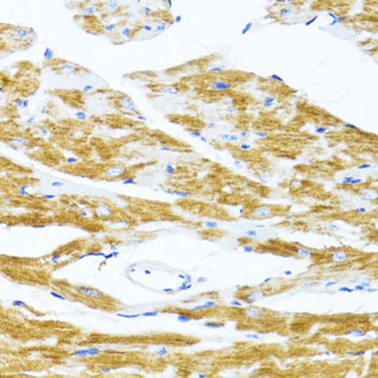 Immunohistochemistry of paraffin-embedded Mouse heart using MS4A8B Polyclonal Antibody at dilution of  1:100 (40x lens).