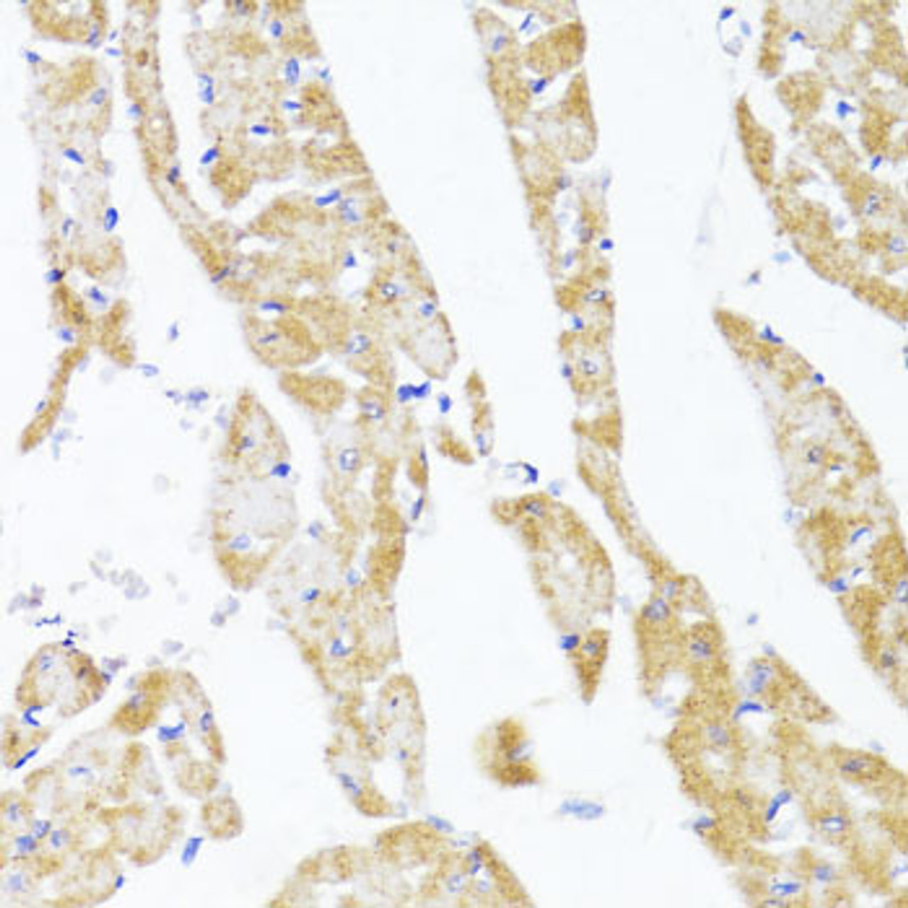 Immunohistochemistry of paraffin-embedded Rat heart using EGLN1/EGLN2 Polyclonal Antibody at dilution of  1:100 (40x lens).