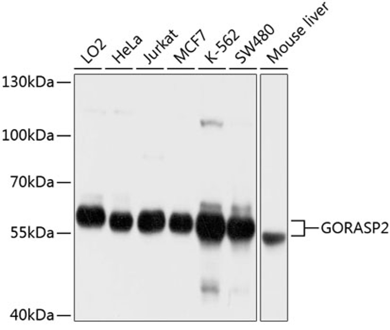 Western blot analysis of extracts of various cell lines using GORASP2 Polyclonal Antibody at dilution of 1:1000.
