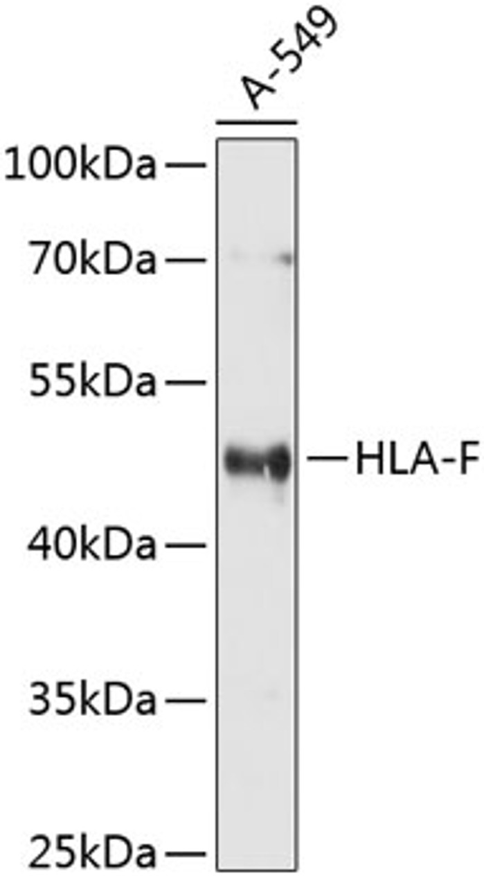 Western blot analysis of extracts of A-549 cells using HLA-F Polyclonal Antibody at dilution of 1:1000.