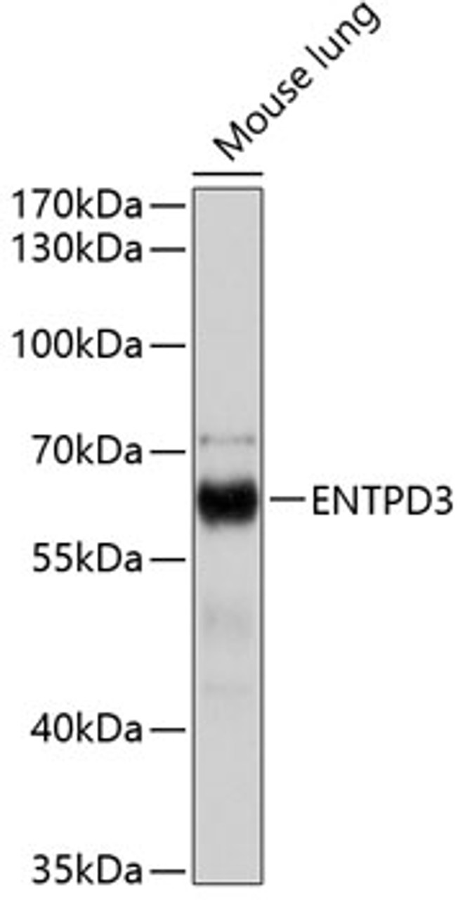 Western blot analysis of extracts of Mouse lung using ENTPD3 Polyclonal Antibody at dilution of 1:1000.