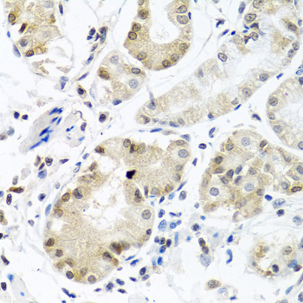 Immunohistochemistry of paraffin-embedded Human stomach using PCBP1 Polyclonal Antibody at dilution of  1:100 (40x lens).