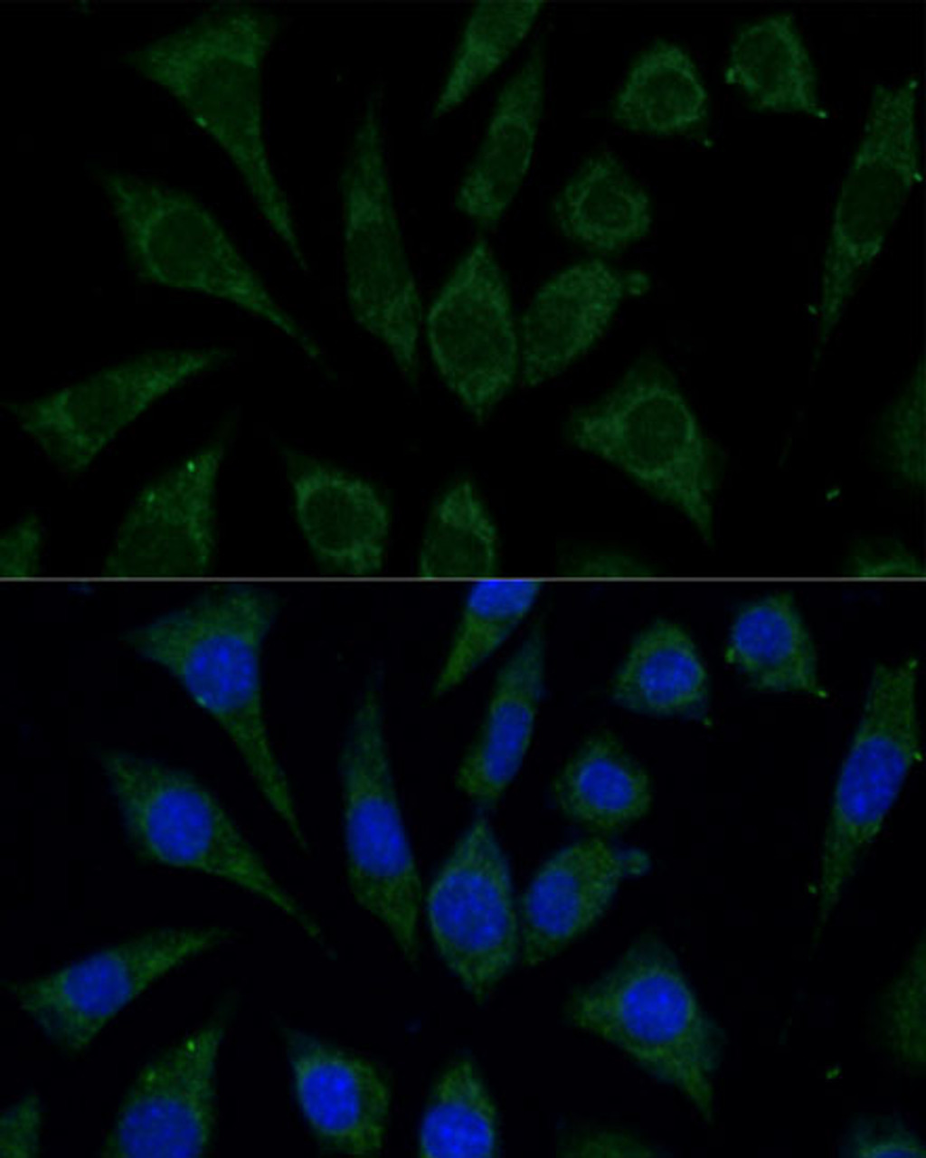 Immunofluorescence analysis of L929 cells using AKR1C2 Polyclonal Antibody at dilution of  1:100 (40x lens). Blue: DAPI for nuclear staining.