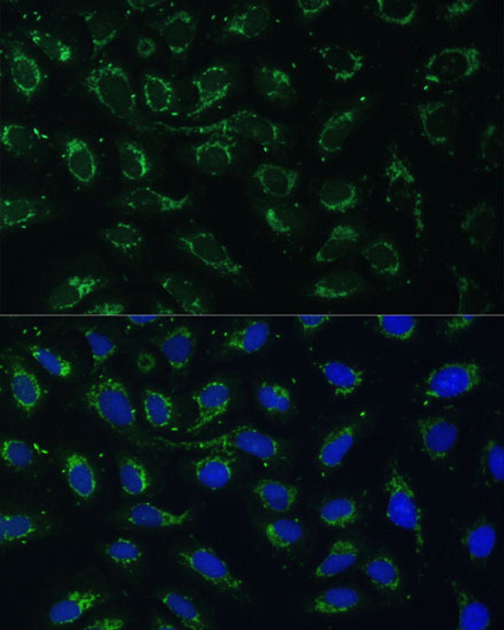 Immunofluorescence analysis of U-2 OS cells using AKR1C2 Polyclonal Antibody at dilution of  1:100 (40x lens). Blue: DAPI for nuclear staining.