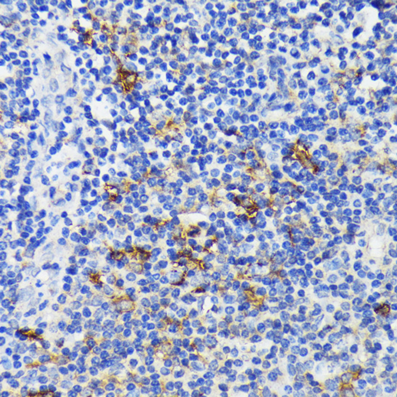 Immunohistochemistry of paraffin-embedded Human tonsil using TREM2 Polyclonal Antibody at dilution of  1:200 (40x lens).