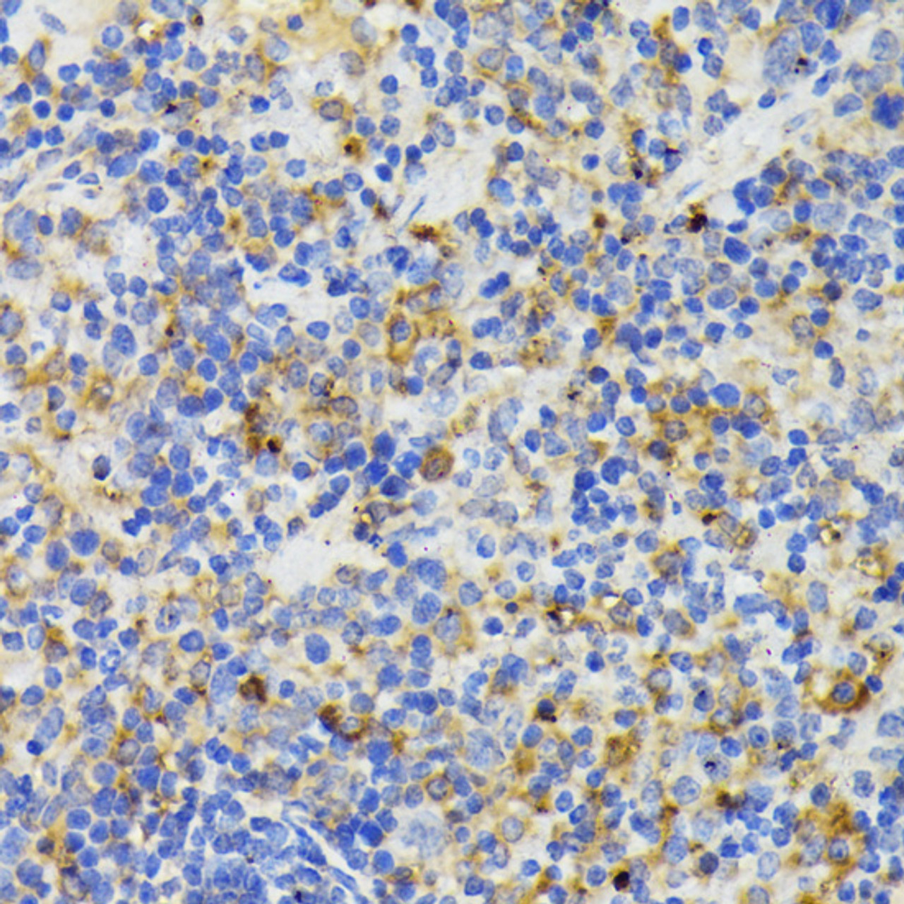 Immunohistochemistry of paraffin-embedded Mouse spleen using TREM2 Polyclonal Antibody at dilution of  1:200 (40x lens).