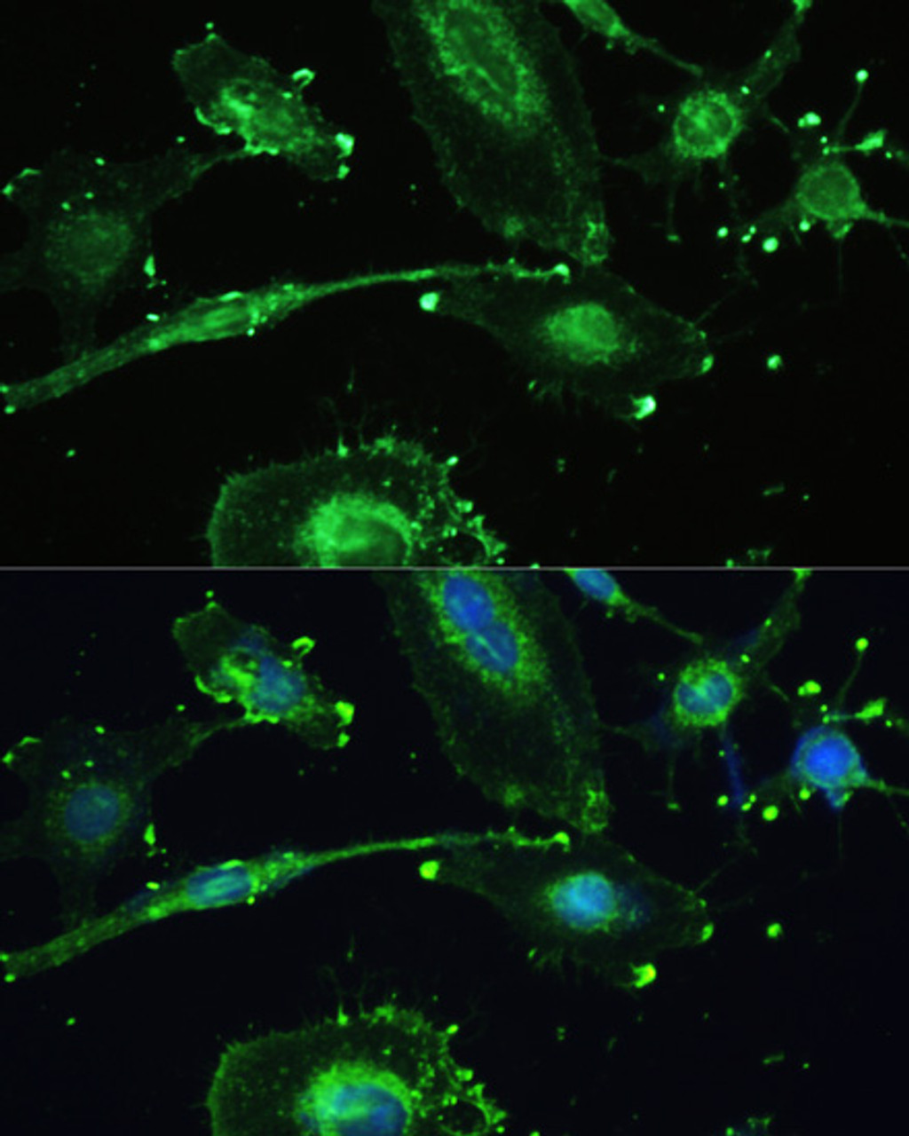 Immunofluorescence analysis of U-251MG cells using TREM2 Polyclonal Antibody at dilution of  1:100. Blue: DAPI for nuclear staining.