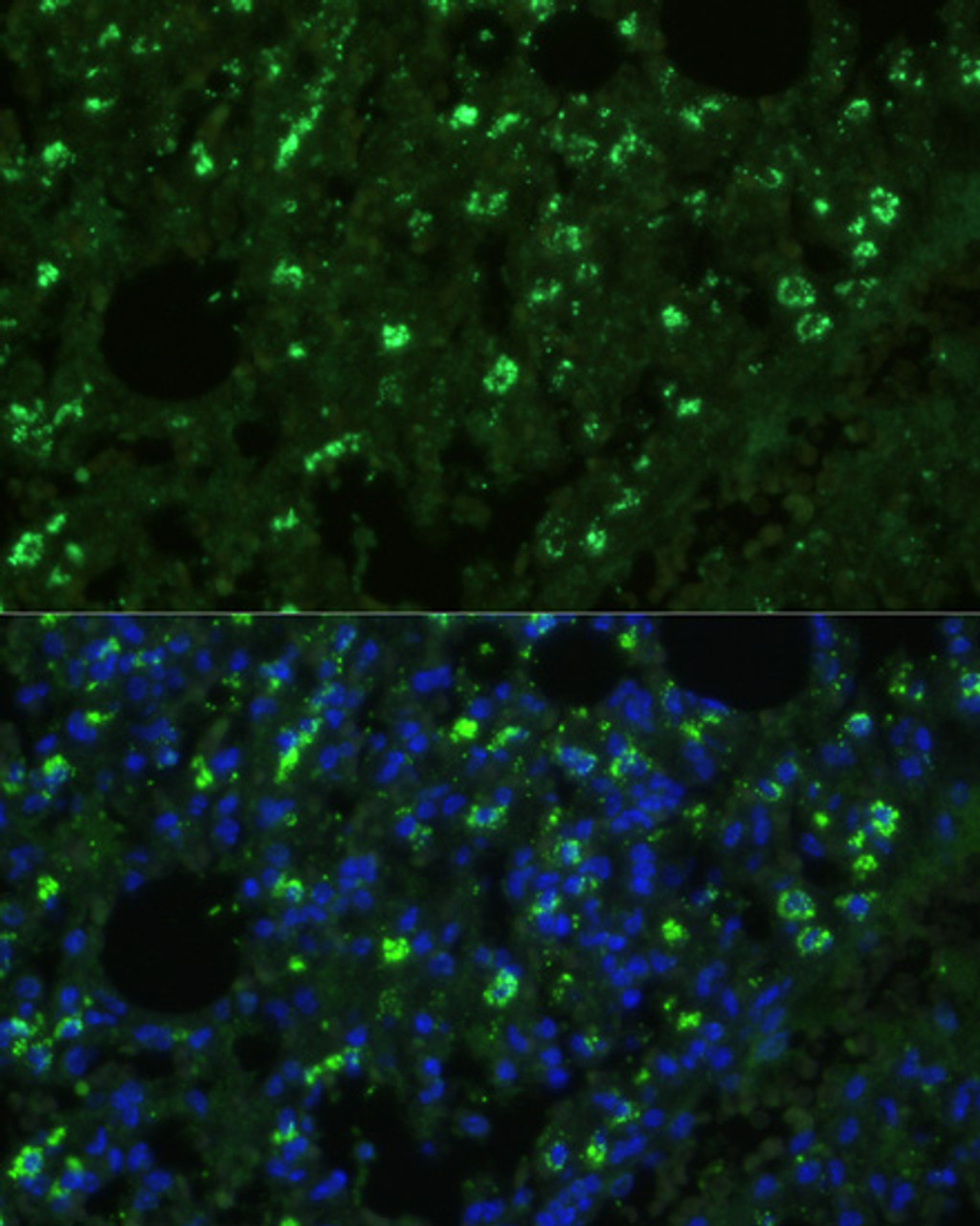 Immunofluorescence analysis of Mouse lung cells using TREM2 Polyclonal Antibody at dilution of  1:100. Blue: DAPI for nuclear staining.