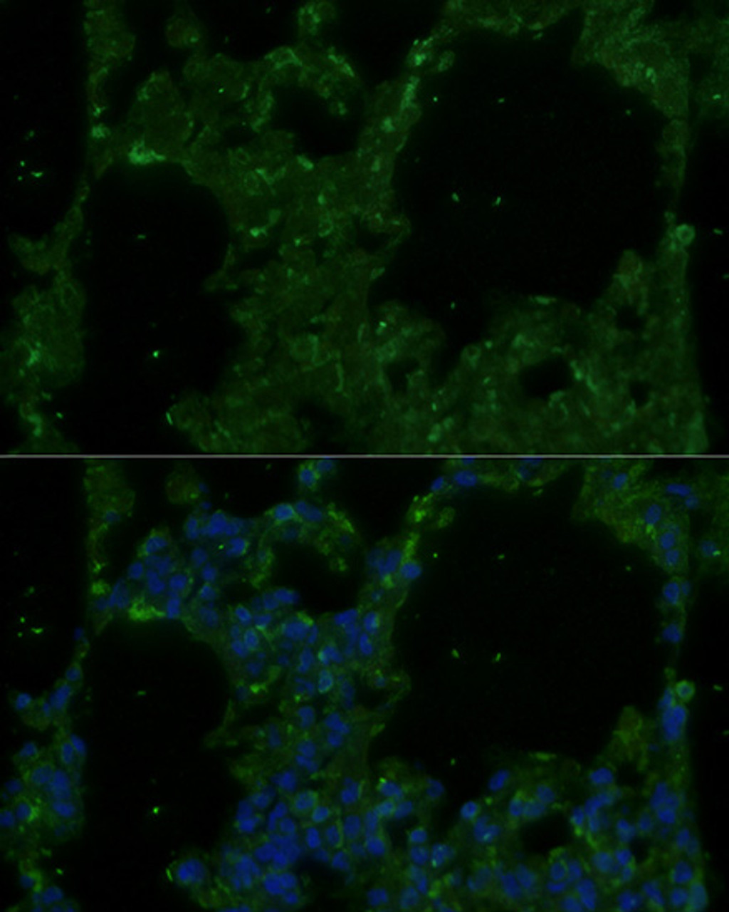Immunofluorescence analysis of Rat lung using TREM2 Polyclonal Antibody at dilution of  1:100. Blue: DAPI for nuclear staining.