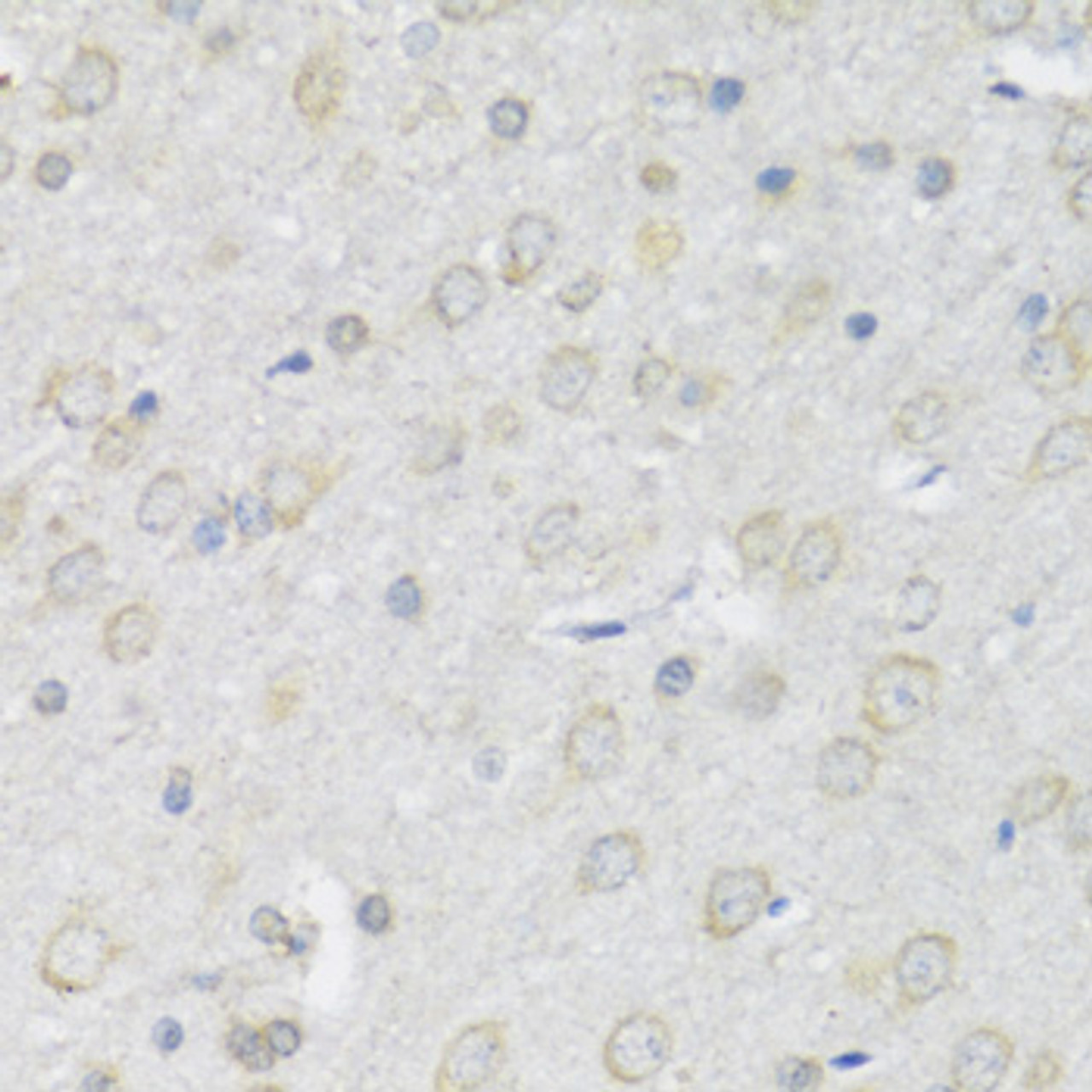 Immunohistochemistry of paraffin-embedded Rat brain using P2RX7 Polyclonal Antibody at dilution of  1:100 (40x lens).