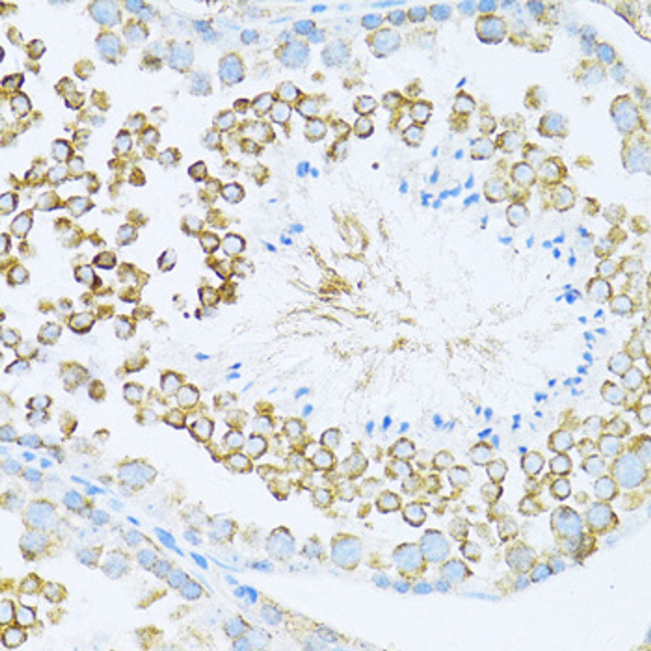 Immunohistochemistry of paraffin-embedded Mouse testis using DVL1 Polyclonal Antibody at dilution of  1:100 (40x lens).