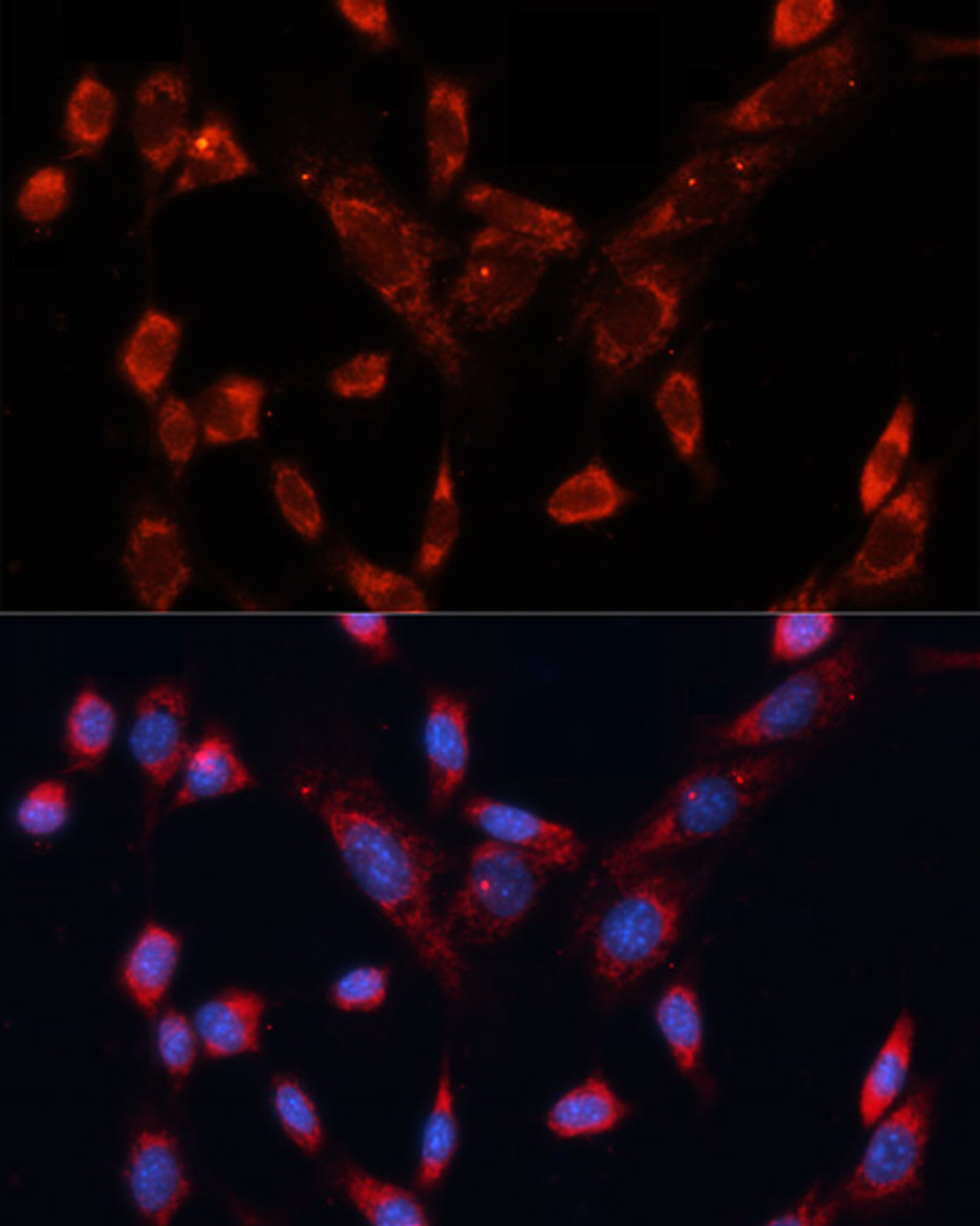 Immunofluorescence analysis of NIH/3T3 cells using DVL1 Polyclonal Antibody at dilution of  1:100. Blue: DAPI for nuclear staining.