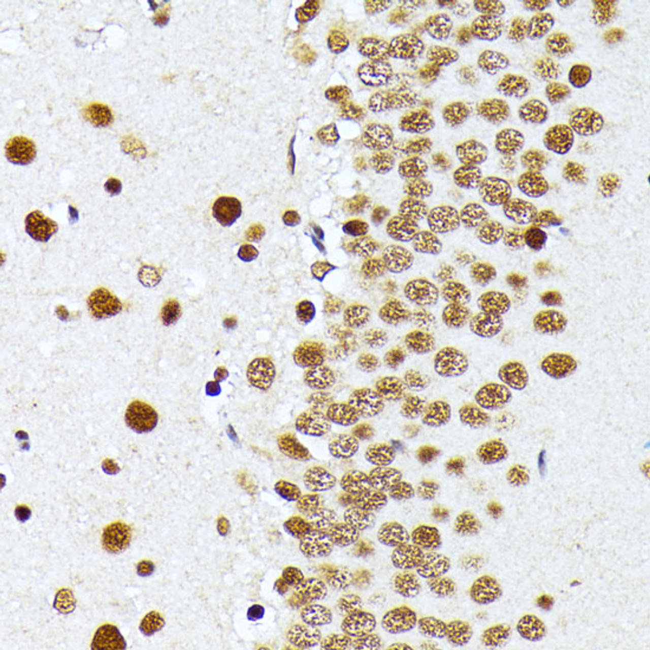 Immunohistochemistry of paraffin-embedded Rat brain using PRMT1 Polyclonal Antibody at dilution of  1:100 (40x lens).