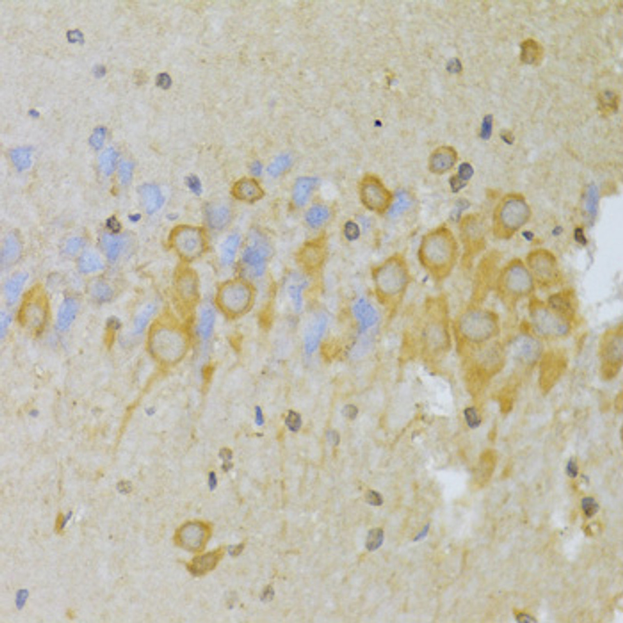 Immunohistochemistry of paraffin-embedded Rat brain using Slug Polyclonal Antibody at dilution of  1:100 (40x lens).