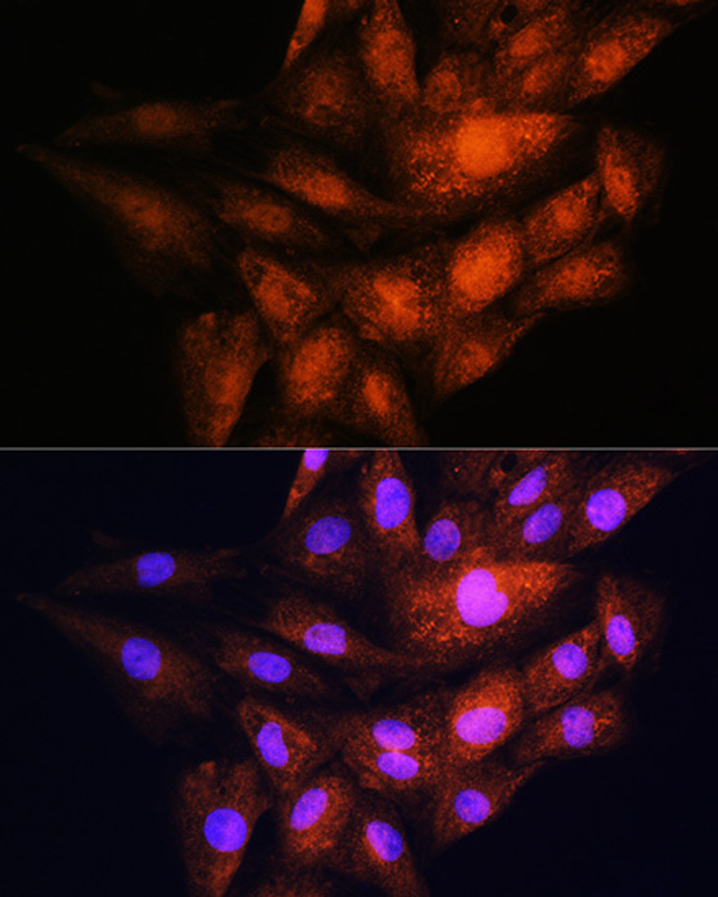 Immunofluorescence analysis of H9C2 cells using YWHAE Polyclonal Antibody at dilution of  1:100. Blue: DAPI for nuclear staining.