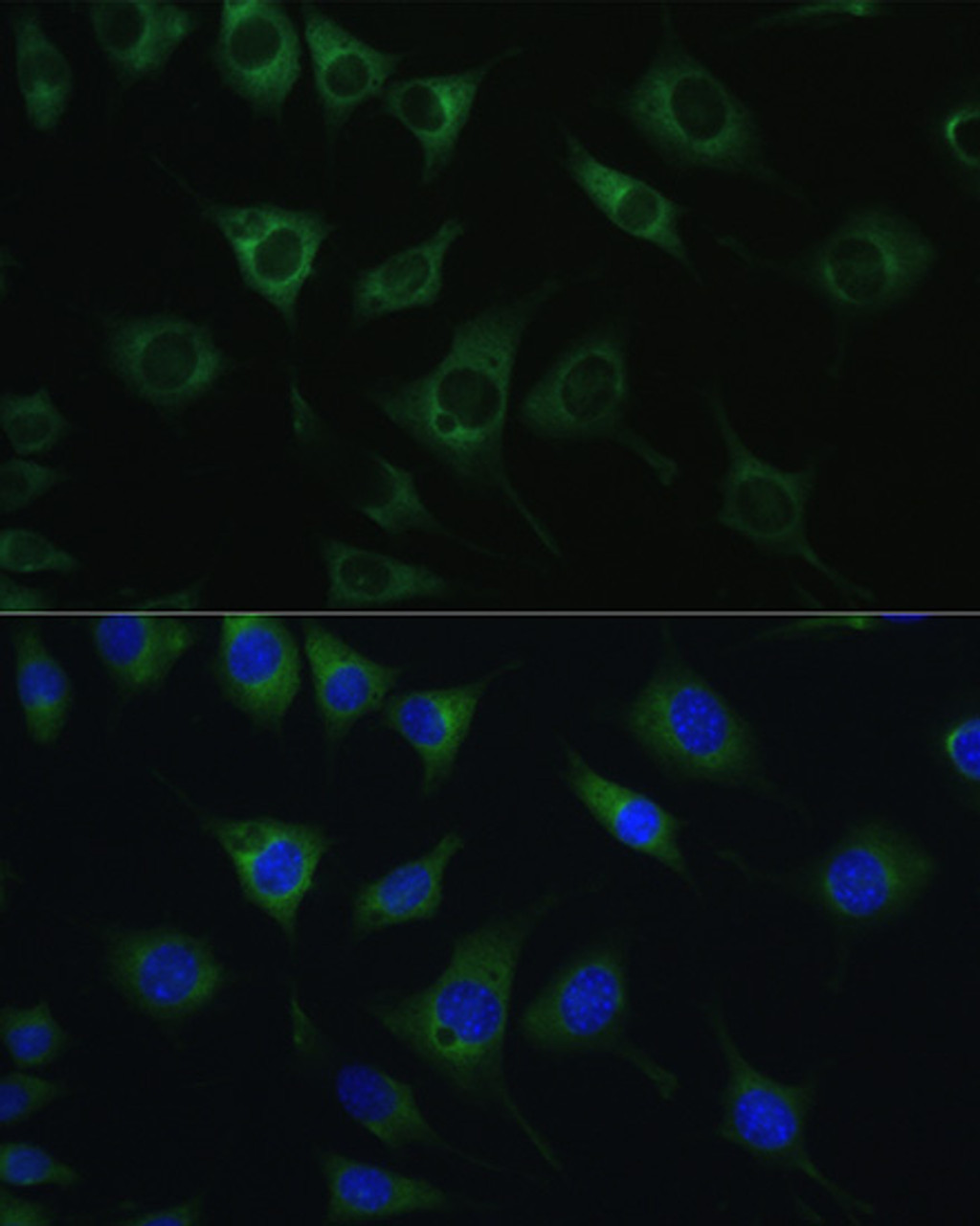 Immunofluorescence analysis of L929 cells using SRPRB Polyclonal Antibody at dilution of  1:100. Blue: DAPI for nuclear staining.