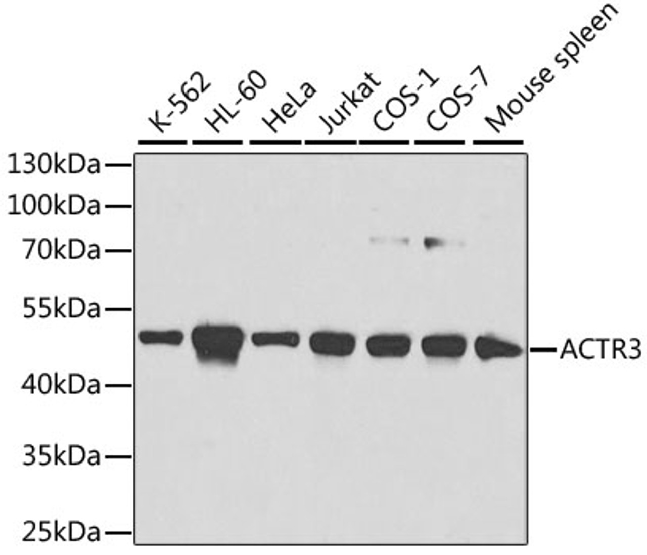 Western blot analysis of extracts of various cell lines using ACTR3 Polyclonal Antibody at dilution of 1:1000.