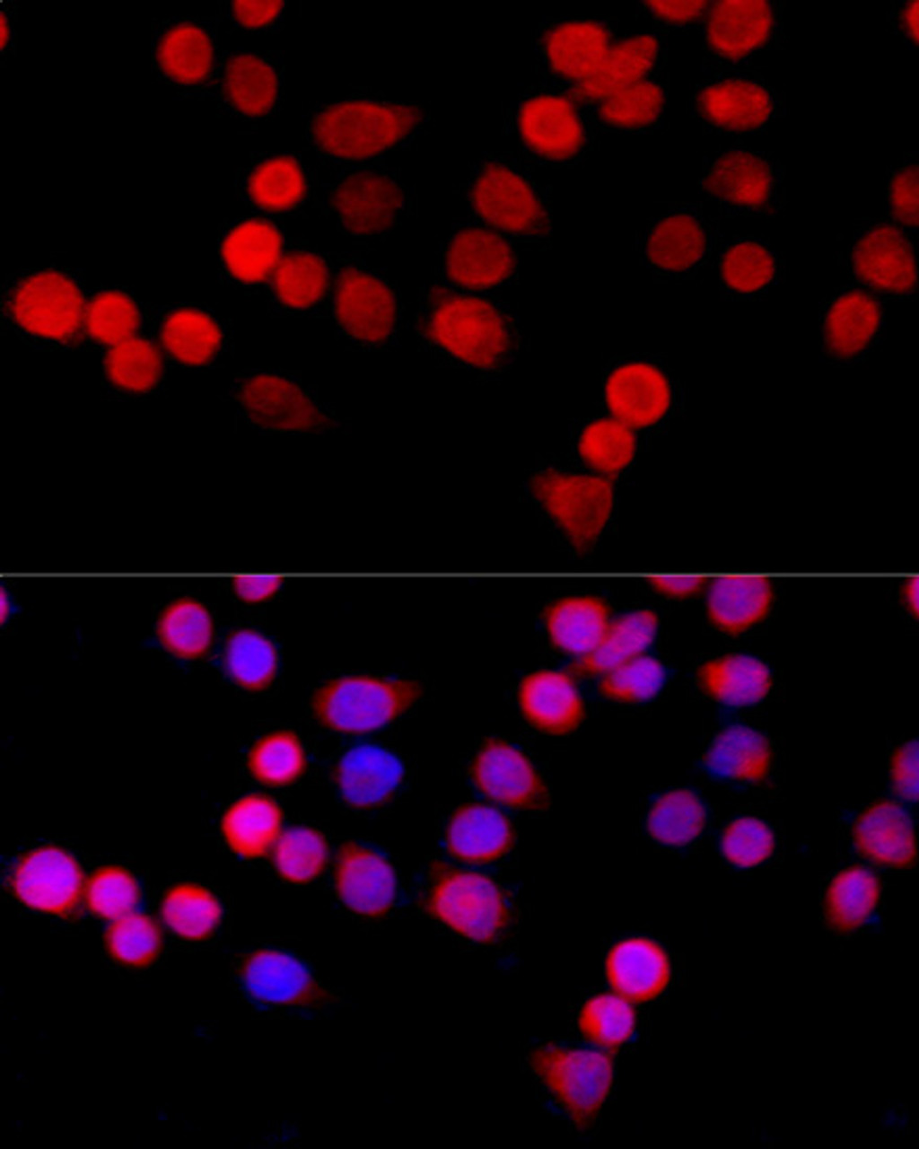 Immunofluorescence analysis of HeLa cells using CYBA Polyclonal Antibody at dilution of  1:100 (40x lens). Blue: DAPI for nuclear staining.