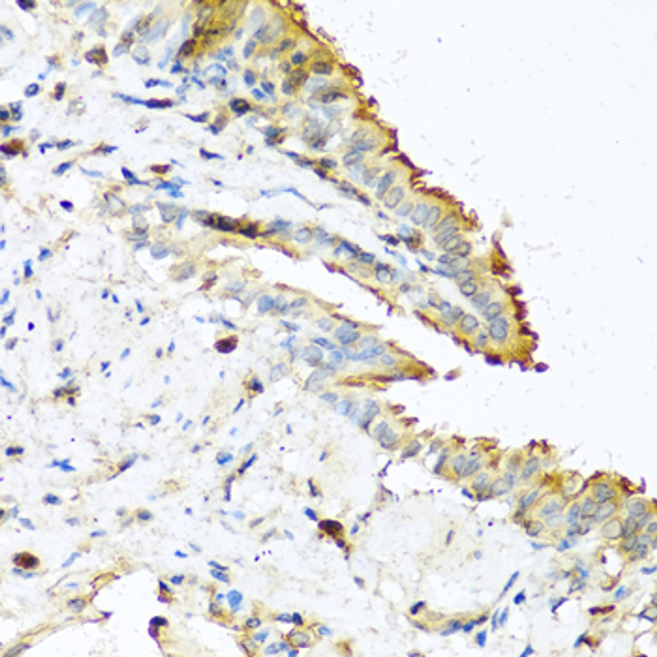 Immunohistochemistry of paraffin-embedded Mouse lung using RNASE13 Polyclonal Antibody at dilution of  1:100 (40x lens).