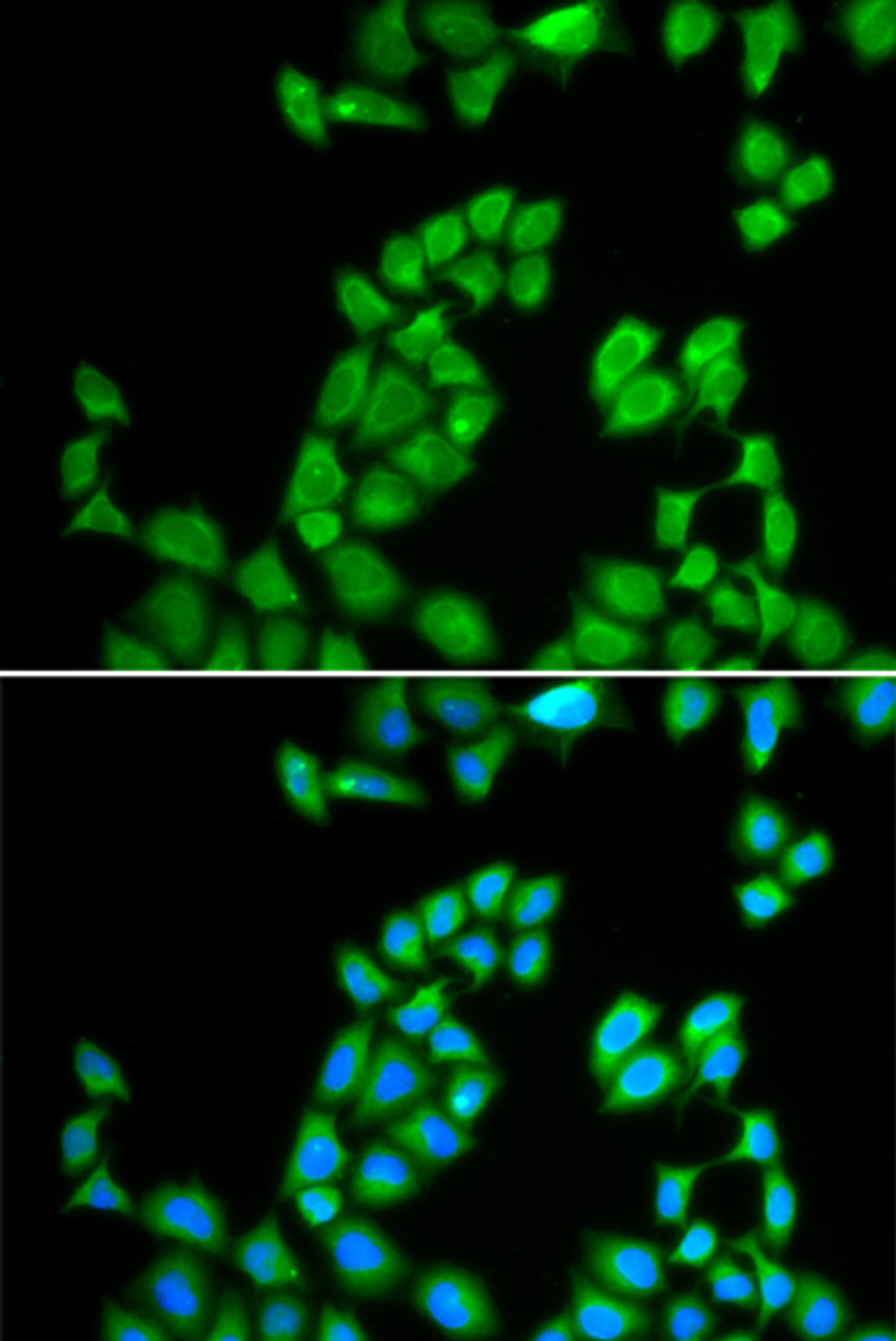 Immunofluorescence analysis of MCF-7 cells using RNASE13 Polyclonal Antibody