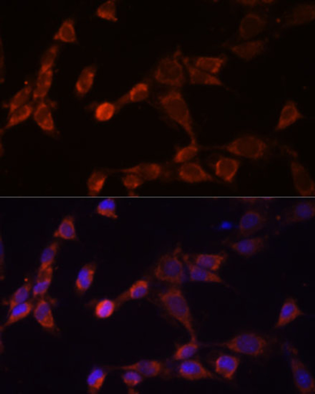 Immunofluorescence analysis of NIH-3T3 cells using PSMD14 Polyclonal Antibody at dilution of  1:100 (40x lens). Blue: DAPI for nuclear staining.