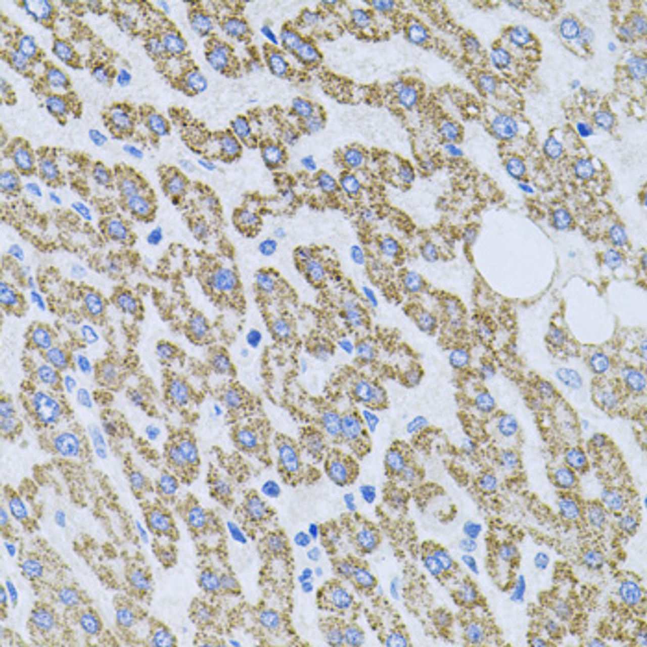 Immunohistochemistry of paraffin-embedded Human liver damage using NTF4 Polyclonal Antibody at dilution of  1:100 (40x lens).